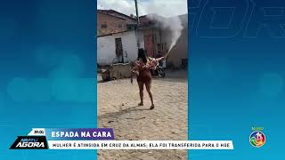 Espada na cara: Mulher é atingida em Cruz da Almas; e foi transferida pro HGE |ARATU AGORA |TV ARATU
